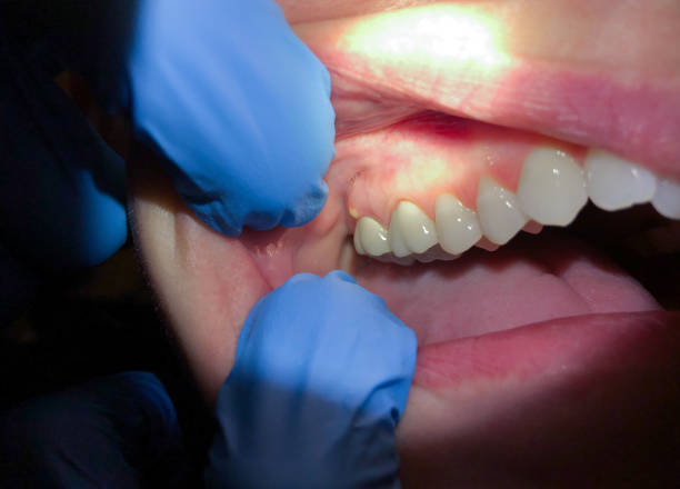 Best Emergency Cosmetic Dentistry (e.g., broken veneers) in Malta, IL